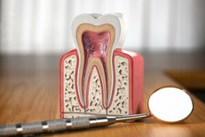 Wurzelbehandlung, Modell/Querschnitt von einem Zahn